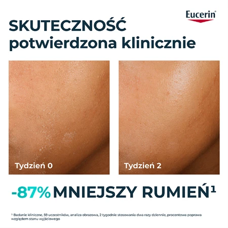 Eucerin DermoPure Clinical Hydra Repair, verzachtende crème voor de acnegevoelige huid, 40 ml