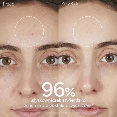 Caudalie Vinopure, gel nettoyant pour le visage, peaux acnéiques, 385 ml