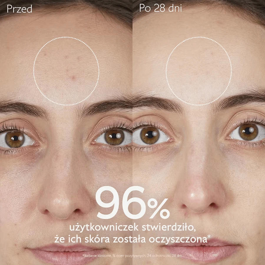 Caudalie Vinopure, gel nettoyant pour le visage, peaux acnéiques, 385 ml