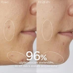 Caudalie Vinopure, gel nettoyant pour le visage, peaux acnéiques, 385 ml
