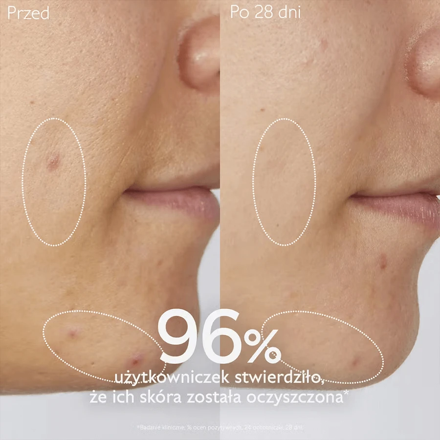 Caudalie Vinopure, gel nettoyant pour le visage, peaux acnéiques, 385 ml