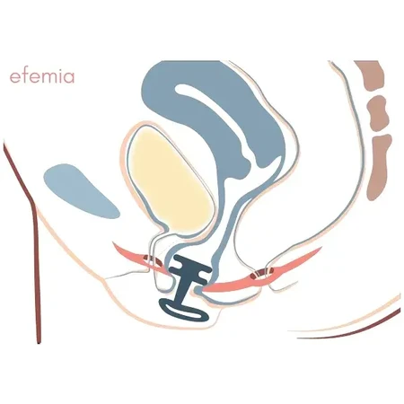 EFEMIA Pessar Absorbente incontinencia femenina, 3 pzs.