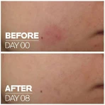 La Roche Posay Cicaplast B5 hydraterend gezichtsserum met Centella Asiatica en vitamine B5 30ml
