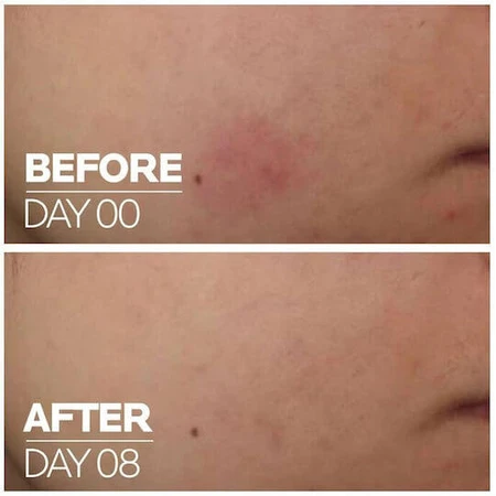 La Roche Posay Cicaplast B5 hydraterend gezichtsserum met Centella Asiatica en vitamine B5 30ml