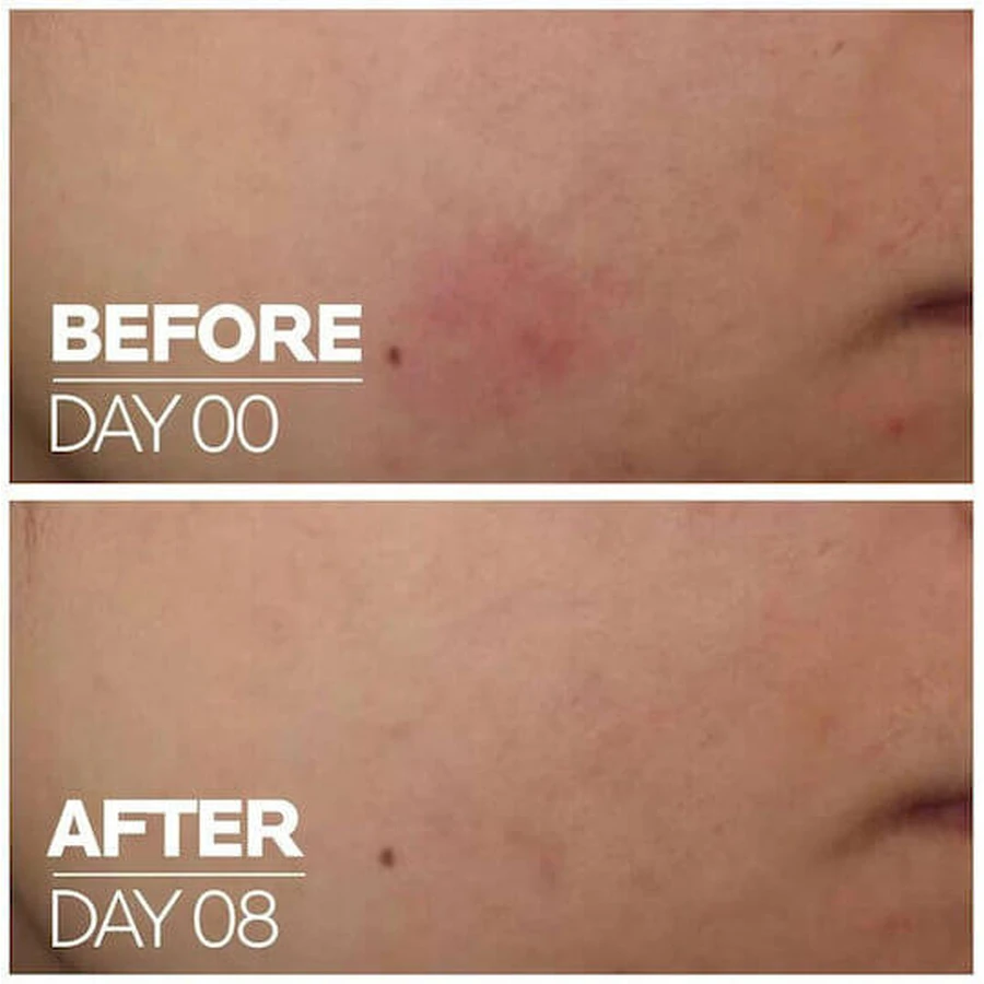 La Roche Posay Cicaplast B5 hydraterend gezichtsserum met Centella Asiatica en vitamine B5 30ml