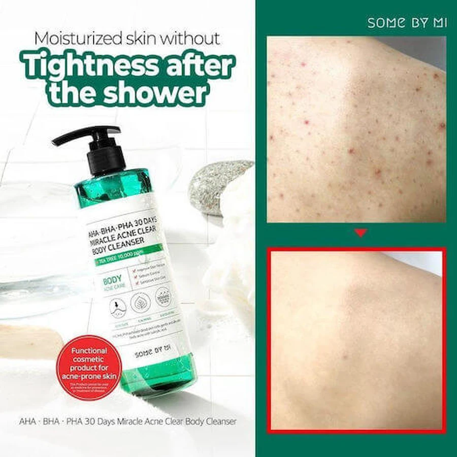 Some By Mi 30 DAYS MIRACLE Body Gel 400gr
