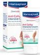 Hansaplast Anti Callus Intensive Cream for Pimples, Calluses with 20% Urea 75ml