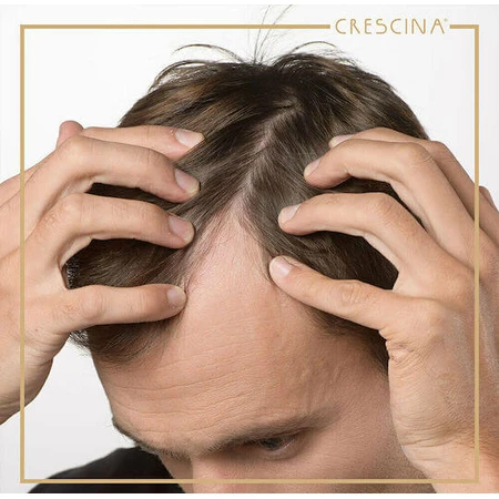 Labo Caducrex Caducrex Transdermic HFSC Hair ampul tegen haaruitval voor mannen 20x3.5ml