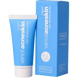 Vencil Acne Crème 30ml
