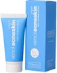Vencil Acne Cream 30ml