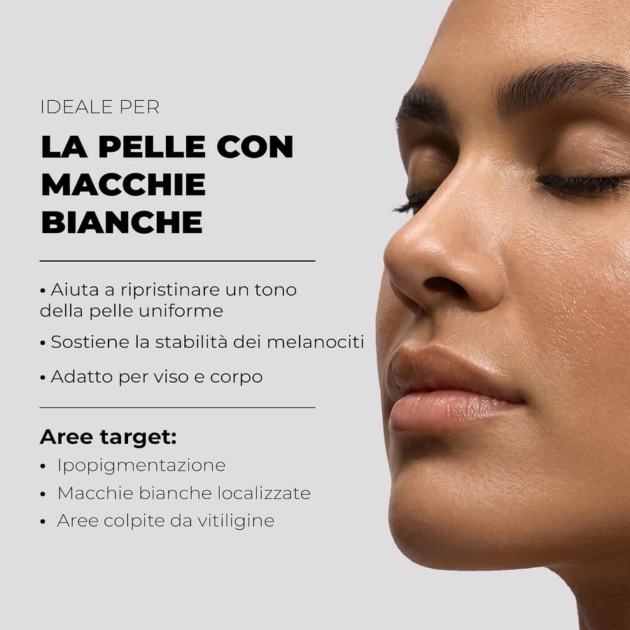 Bella aurora repigment12 repigmentierende Creme 75 ml
