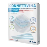 hitech connettivina ipsos 10 x 10 cm 4 bucăți
