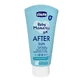 Chicco Baby Moments Body Milk Aftersun 150Ml