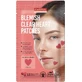 Purederm Blemish Clear Parches Corazón Parches Eczema ...