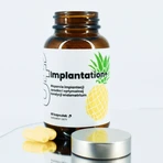 UP Implantatie+, capsules, 60 stuks.
