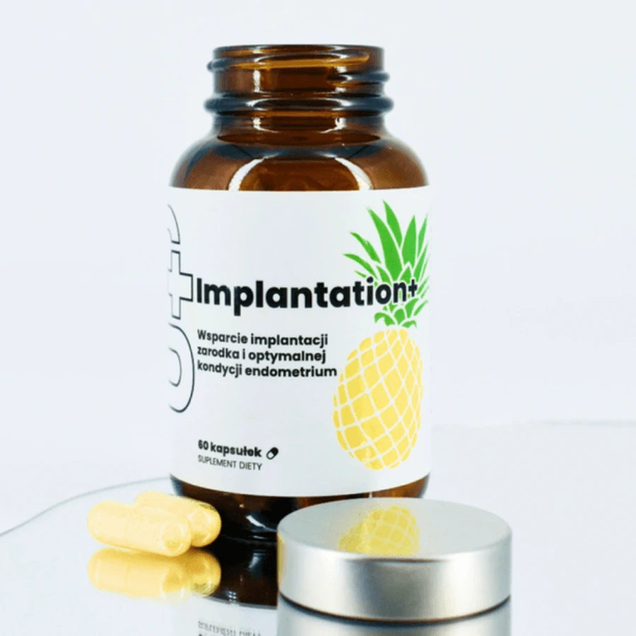 UP Implantatie+, capsules, 60 stuks.