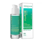 Miraculum stopAcne, normalisierendes Serum, 30 ml