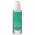 Miraculum stopAcne, normalisierendes Serum, 30 ml
