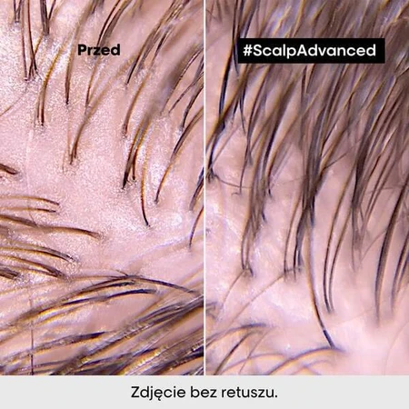 L'Oreal Scalp Advanced, reinigende shampoo, 1,5 l