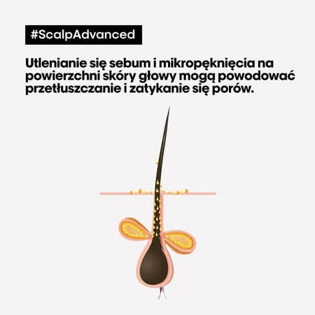 L'Oreal Scalp Advanced, reinigende shampoo, 1,5 l