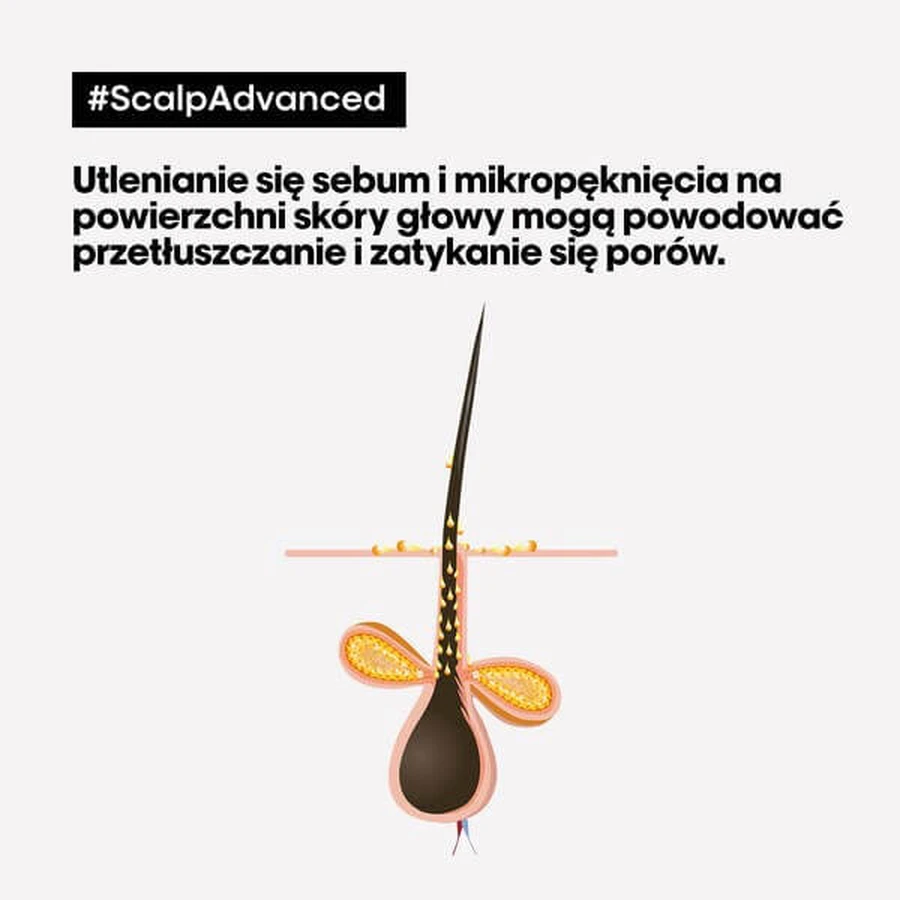 L'Oreal Scalp Advanced, reinigende shampoo, 1,5 l