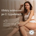 Silk'n Infinity Fast, eHPL IPL epilator voor gezicht en lichaam, 1 st.