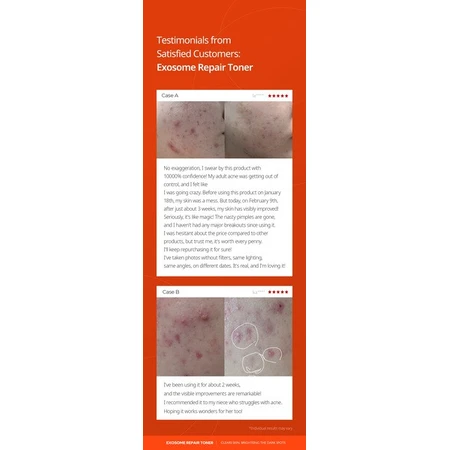 Dr.Melaxin Exosome Repair Toner, tónico reparador de exosomas, 300 ml