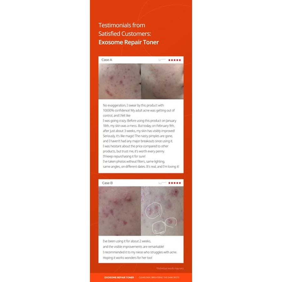 Dr.Melaxin Exosome Repair Toner, tónico reparador de exosomas, 300 ml