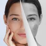 Miraculum Anti-Pigmentación, crema de noche iluminadora de la decoloración, 50 ml