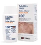 Fotoultra Solar Allergy