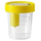 Meds Urine stérile Container Vacuum 120 Ml