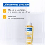 Mixa Anti-stretch mark oil against signs of pregnancy or weight changes 100 ml