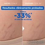 Mixa Anti-stretch mark oil against signs of pregnancy or weight changes 100 ml