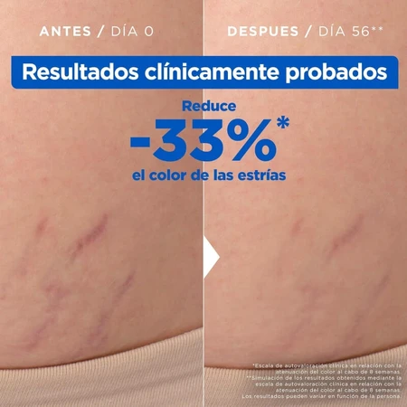 Mixa Anti-stretch mark oil against signs of pregnancy or weight changes 100 ml