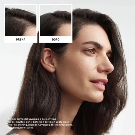 Nioxin System 3 kit - volumizing shampoo 300 ml + conditioner 300 ml + treatment 100 ml box set