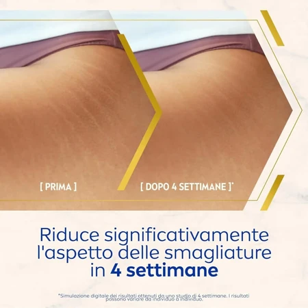 Nivea luminous 360 - Anti-Dehnungsstreifen Körper Serum Öl 100 ml