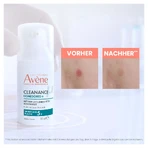 Avène Cleanance onzuivere huid 1 set