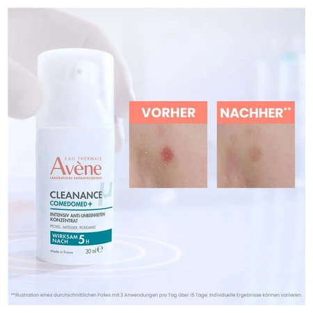 Avène Cleanance onzuivere huid 1 set