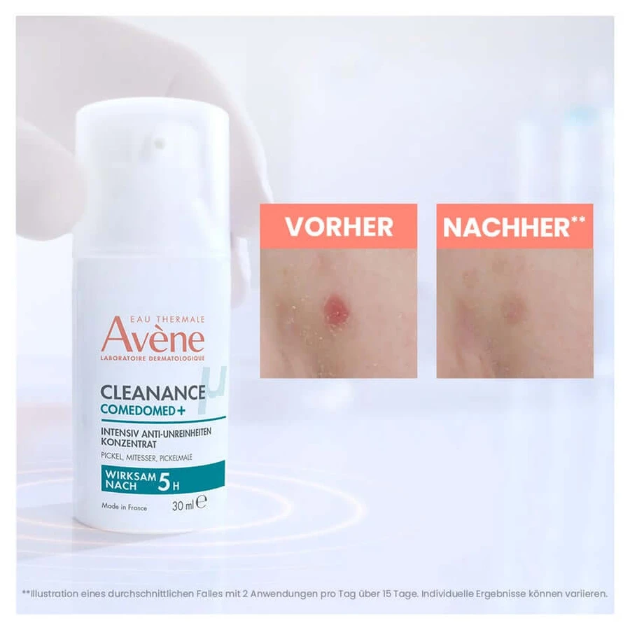 Avène Cleanance onzuivere huid 1 set