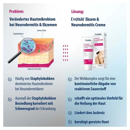 Evolsin Eczema & Neurodermatitis Cream 50 ml