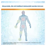 EndWarts FREEZE 7,5 g