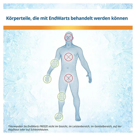 EndWarts FREEZE 7,5 g