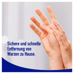 Wartner Wart Spray 50 ml