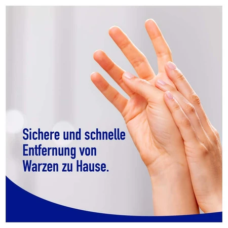 Wartner Wart Spray 50 ml