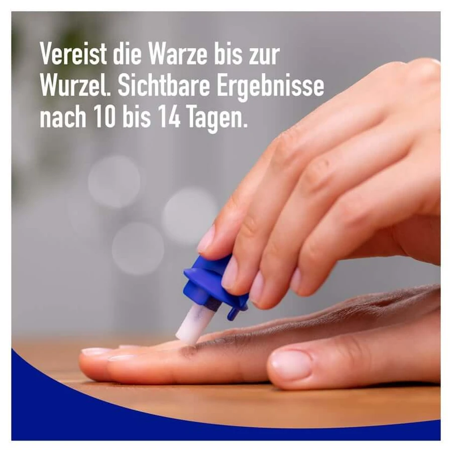 Wartner Wart Spray 50 ml