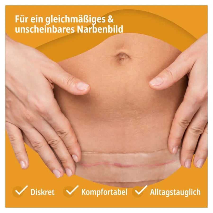 Evolsin Narbenpflaster 2 cmx200 cm 1 St