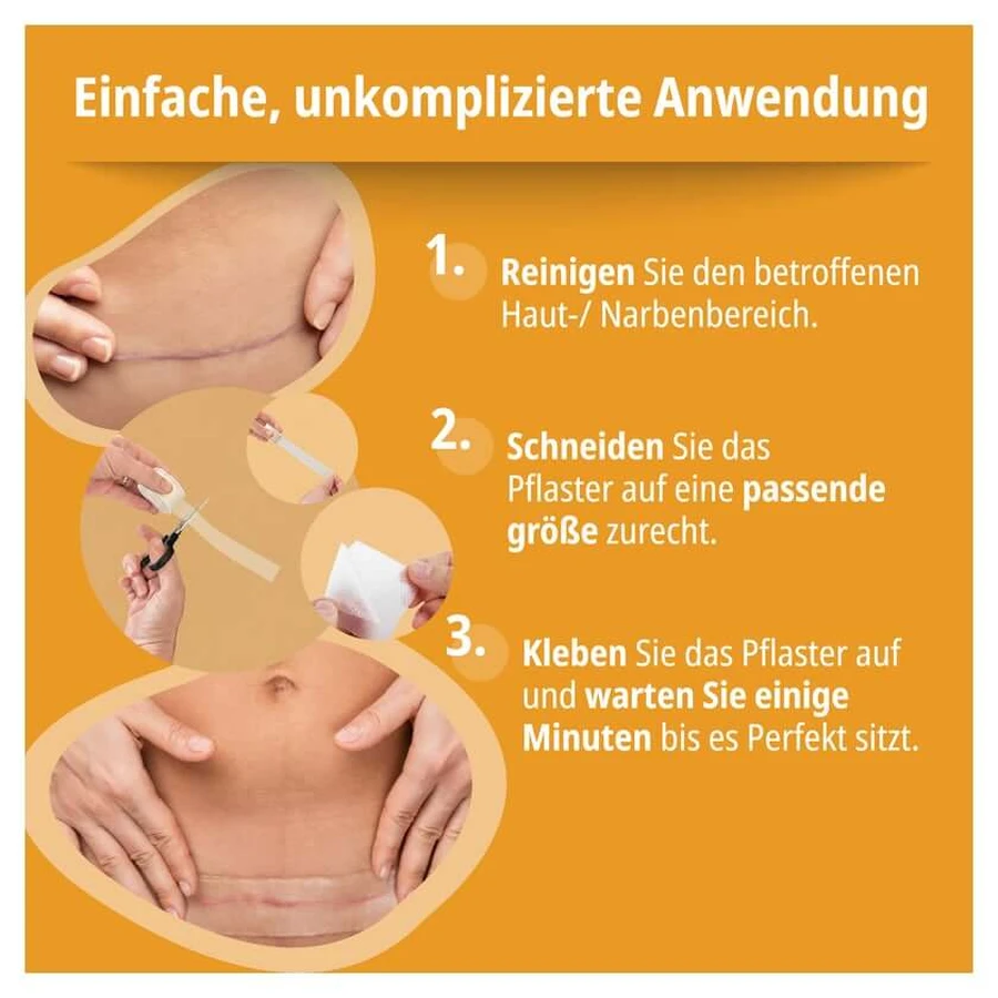 Evolsin Narbenpflaster 2 cmx200 cm 1 St
