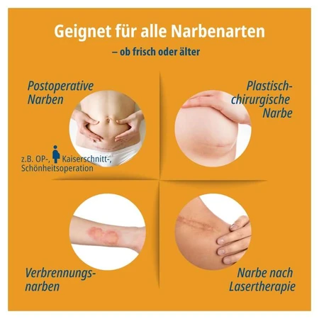 Evolsin Narbenpflaster 2 cmx200 cm 1 St