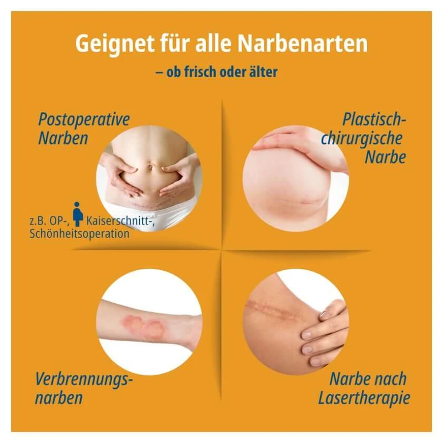 Evolsin Narbenpflaster 2 cmx200 cm 1 St