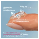 Kelo-cote silicone gel for the treatment of 15 g